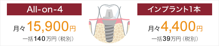 インプラントの価格はこちら